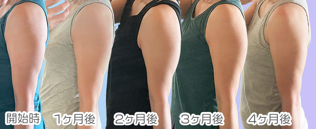 フィットボクシングを始めてから4ヶ月目までの二の腕の写真